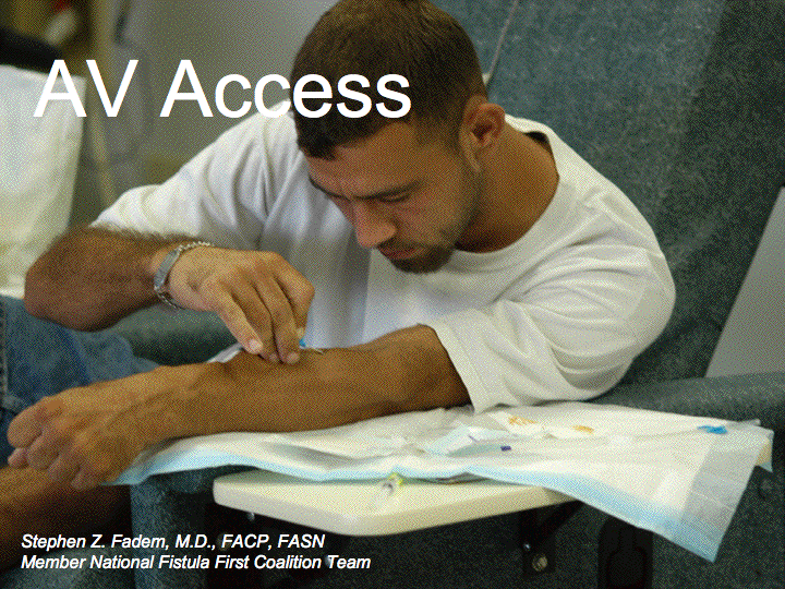 AV Access preview